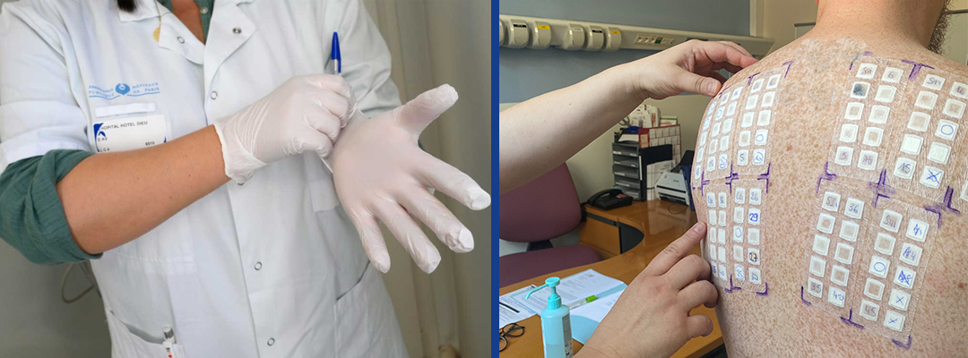 Bandeau intranet test épicutanés